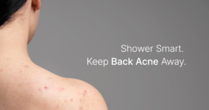 Back Acne & Sweat Pimples: Daily Shower Habits That Help Keep Skin Clear