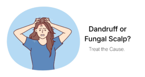 Dandruff or Fungal Scalp? Understanding the Difference in Rainy Weather