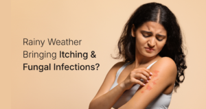 Rainy Season Itching & Fungal Infections: How to Protect Sweat-Prone Skin